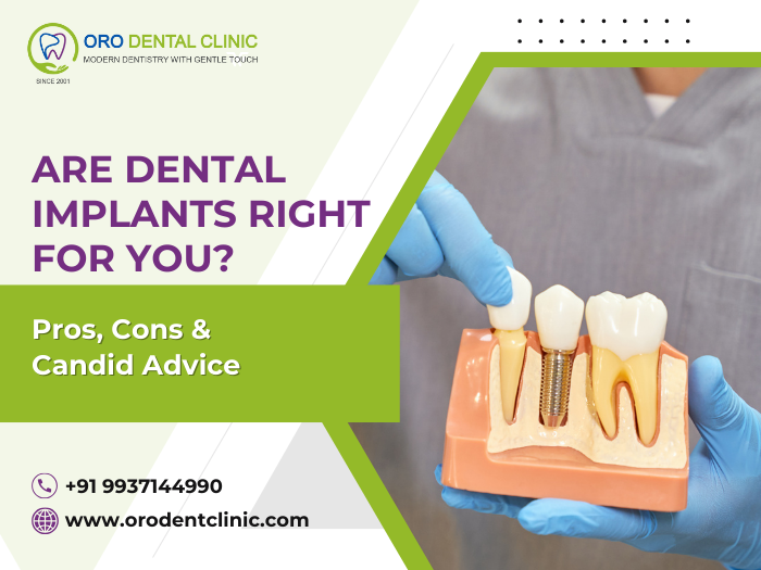 Are Dental Implants Right for You Pros Cons Candid Advice