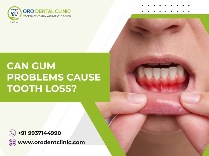 Can Gum Problems Cause Tooth Loss?