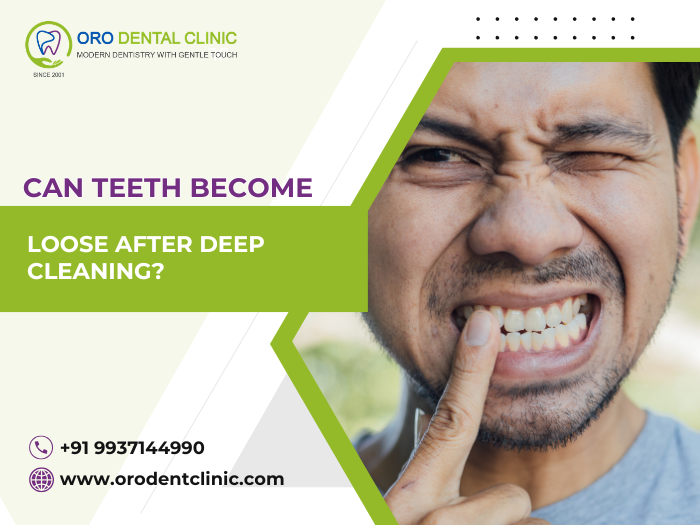 Can Teeth Become Loose After Deep Cleaning?