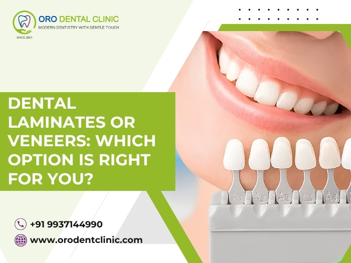 Dental Laminates Vs Veneers: What’s The Difference?