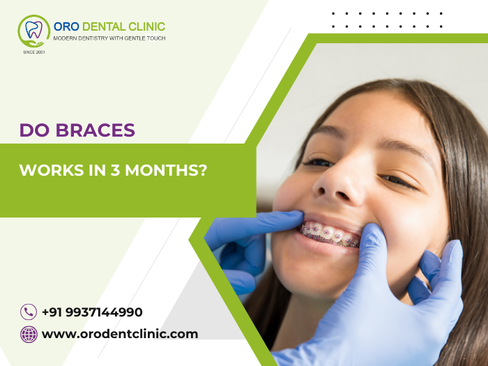Do Braces Work in 3 Months?