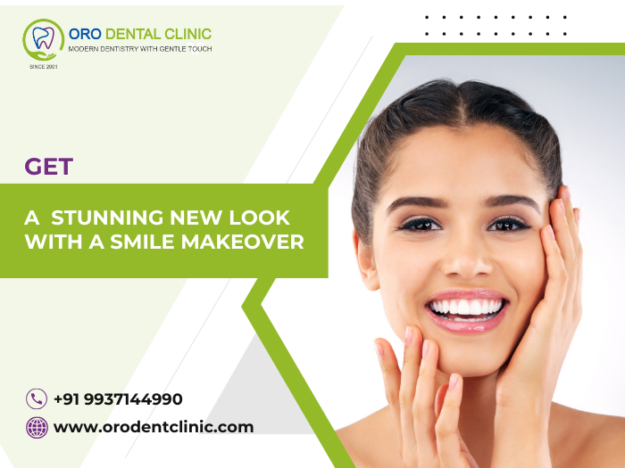 Get a Stunning New Look with a Smile Makeover