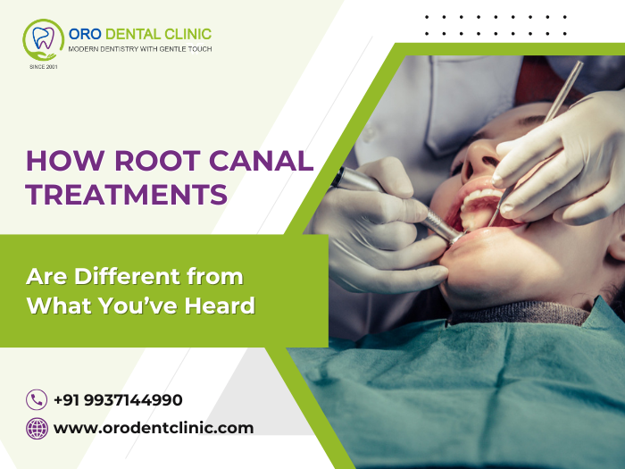 How Root Canal Treatments Are Different from What Youve Heard
