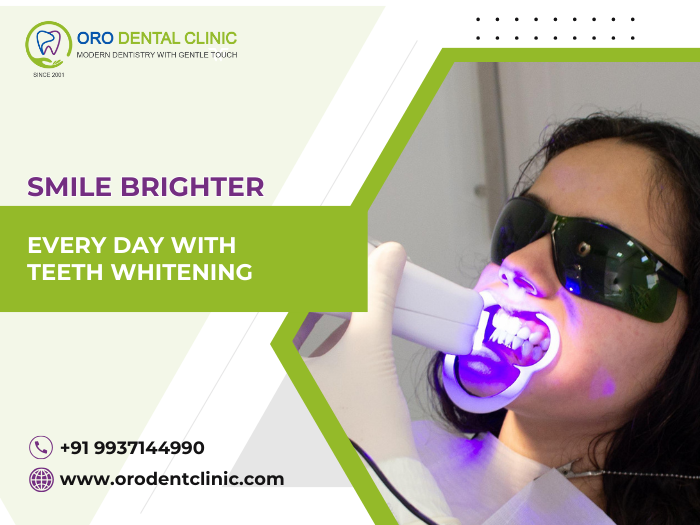 Smile Brighter Every Day with Teeth Whitening