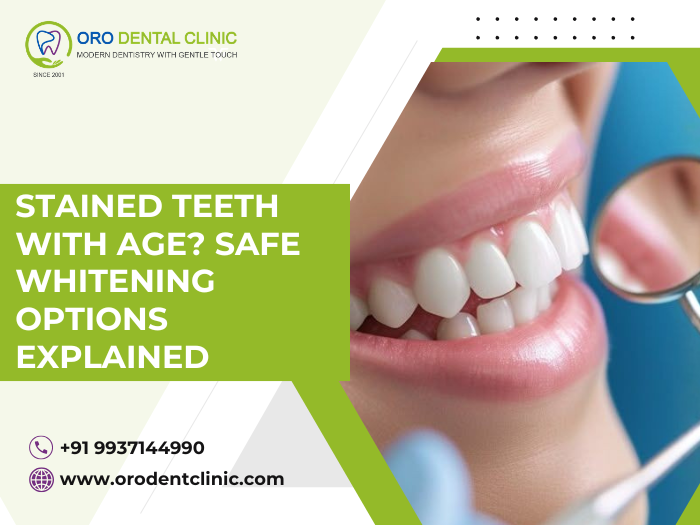 Stained Teeth with Age? Safe Whitening Options Explained