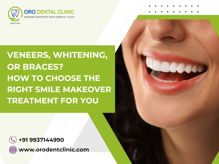 Veneers, Whitening, or Braces? How to Choose the Right Smile Makeover Treatment For You