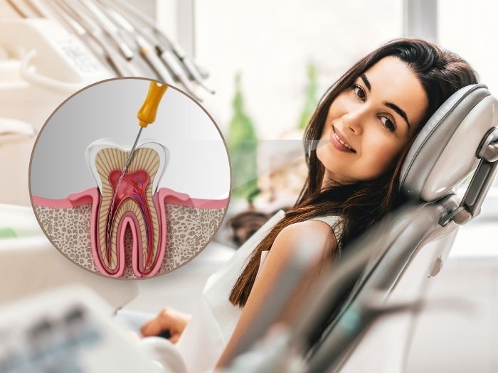 What Are the Benefits of Painless Root Canal Treatment