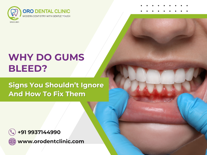 Why Do Gums Bleed? Signs You Shouldn’t Ignore and How to Fix Them