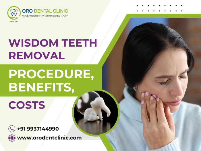 Wisdom Teeth Removal Procedure Benefits and Costs